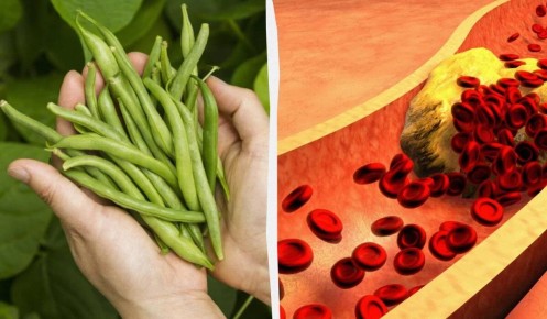 Зеленая фасоль: секрет здоровья при высоком холестерине